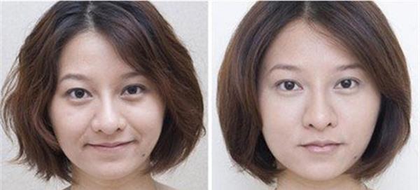 光子<a href=http://m.f3bb6.cn/listinfo-792-0.html target=_blank class=infotextkey>去法令紋</a>效果怎么樣？