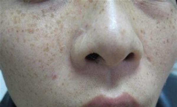 <a href=http://m.f3bb6.cn/listinfo-786-0.html target=_blank class=infotextkey>去黃褐斑</a>的妙招