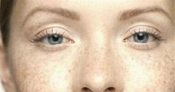 什幺東西去斑最好