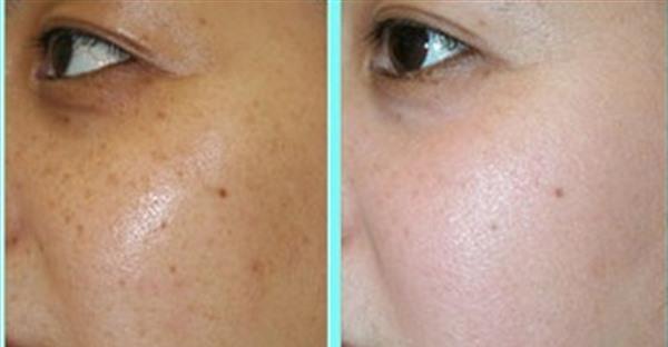 怎么淡斑<a href=http://m.f3bb6.cn/listinfo-795-0.html target=_blank class=infotextkey>祛斑</a>