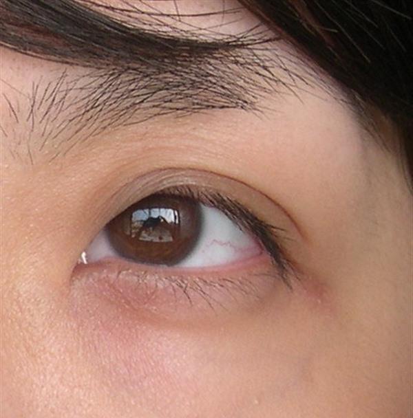 <a href=http://m.f3bb6.cn/listinfo-782-0.html target=_blank class=infotextkey>去眼角細紋</a>失敗修復價格