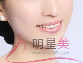 多大臉型就不變了