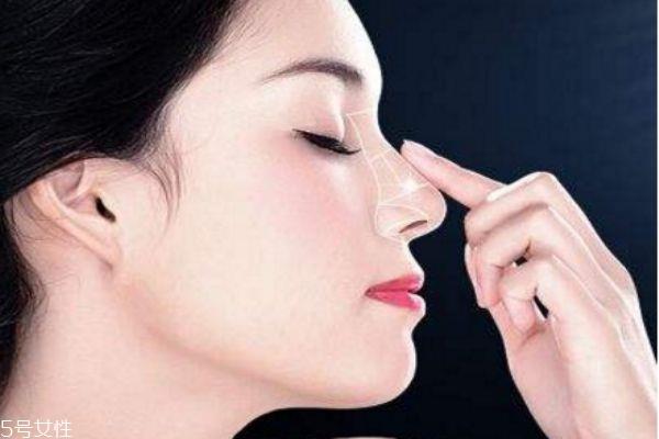 <a href=http://m.f3bb6.cn/listinfo-737-0.html target=_blank class=infotextkey>隆鼻</a>修復(fù)安全嗎 鼻修復(fù)失敗案例