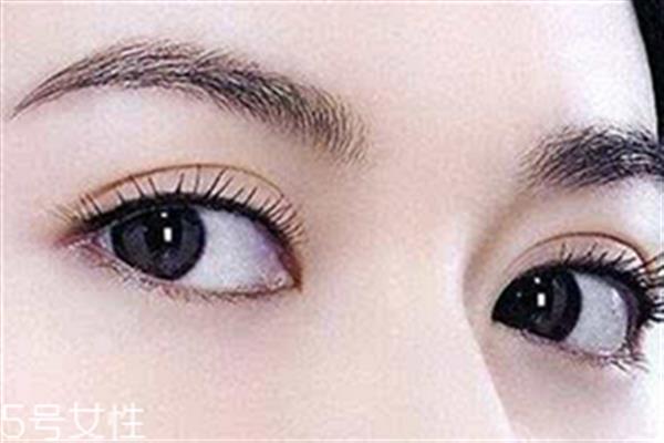 割<a href=http://m.f3bb6.cn/listinfo-724-0.html target=_blank class=infotextkey>雙眼皮</a>眼睛腫怎么辦？疤克可以預防疤痕增生