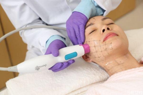 <a href=http://m.f3bb6.cn/listinfo-610-0.html target=_blank class=infotextkey>熱瑪吉</a>治療多久能看到效果 <a href=http://m.f3bb6.cn/listinfo-610-0.html target=_blank class=infotextkey>熱瑪吉</a>做幾次有效果