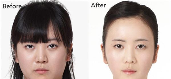 做水氧活膚價格