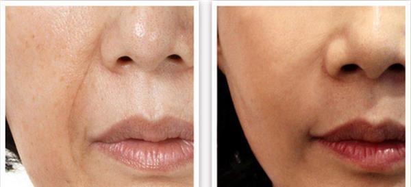 <a href=http://m.f3bb6.cn/listinfo-734-0.html target=_blank class=infotextkey>愛貝芙</a><a href=http://m.f3bb6.cn/listinfo-771-0.html target=_blank class=infotextkey>去眉間紋</a>手術(shù)安全嗎？