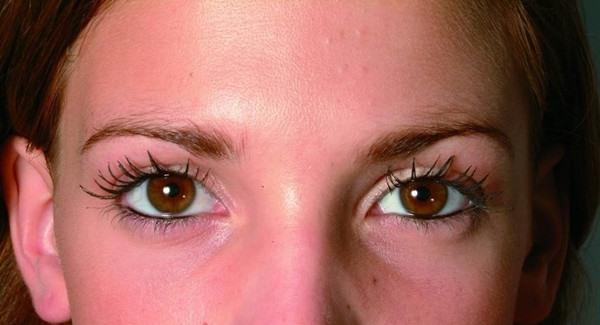 <a href=http://m.f3bb6.cn/listinfo-795-0.html target=_blank class=infotextkey>祛斑</a>危害