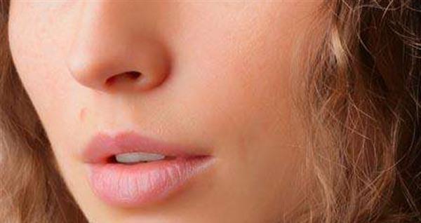 疤痕能徹底去除嗎