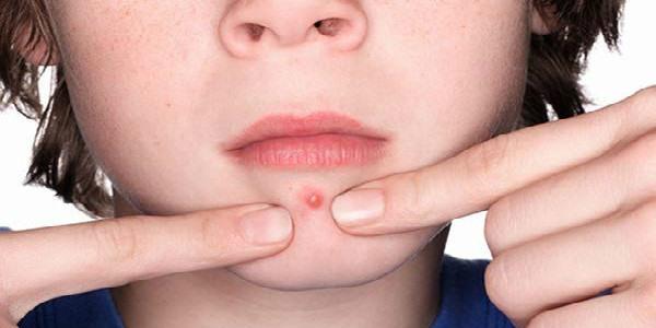 臉上怎么樣<a href=http://m.f3bb6.cn/listinfo-762-0.html target=_blank class=infotextkey>去脂肪粒</a>