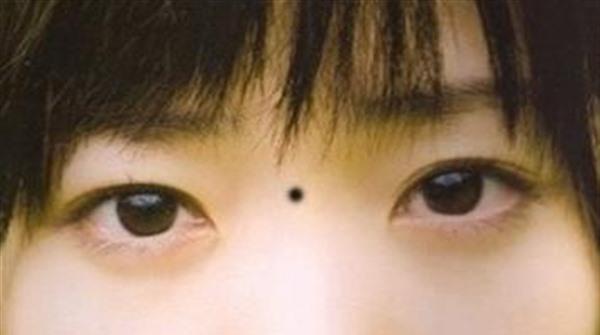 微晶磨削點(diǎn)痣價(jià)格多少錢