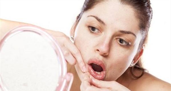 青春痘的簡單治療方法