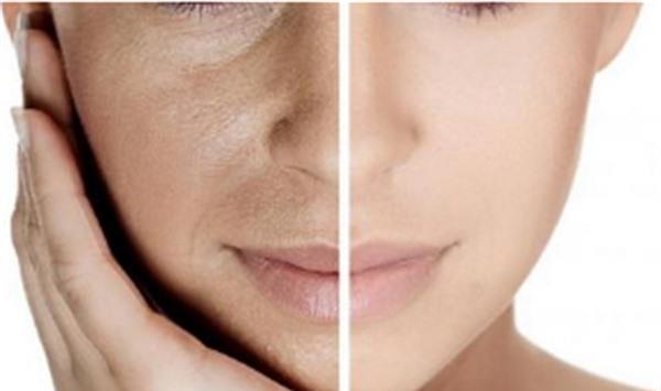 水氧活膚有副作用嗎？