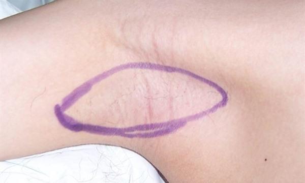 <a href=http://m.f3bb6.cn/listinfo-784-0.html target=_blank class=infotextkey>去狐臭</a>痛不痛