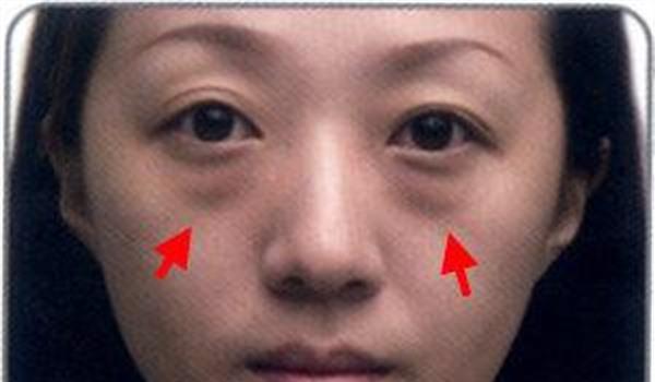 做微晶磨皮<a href=http://m.f3bb6.cn/listinfo-782-0.html target=_blank class=infotextkey>去眼角細紋</a>風險有哪些