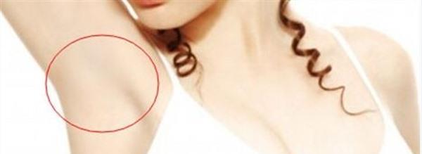 做激光<a href=http://m.f3bb6.cn/listinfo-766-0.html target=_blank class=infotextkey>去腋臭</a>風險有哪些