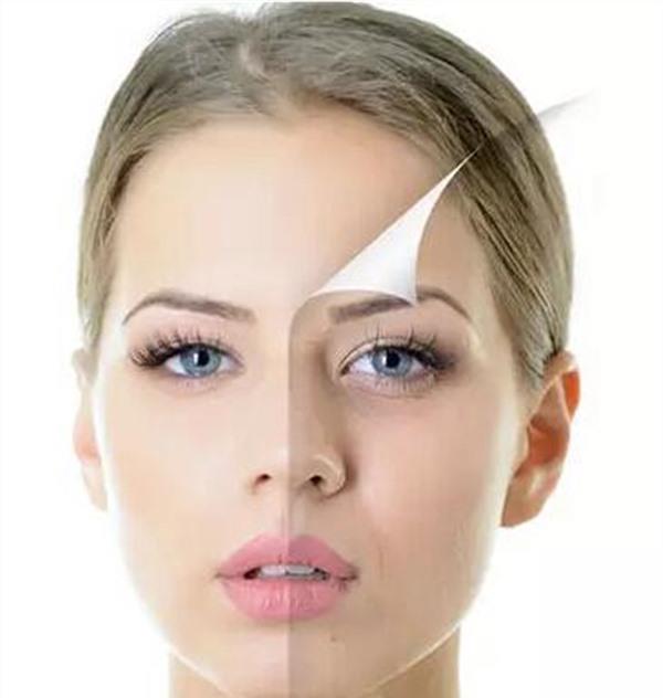 光子美白價(jià)格要多少？