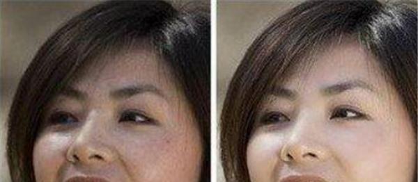 做冷凍治療<a href=http://m.f3bb6.cn/listinfo-797-0.html target=_blank class=infotextkey>去痘疤</a>價格多少錢