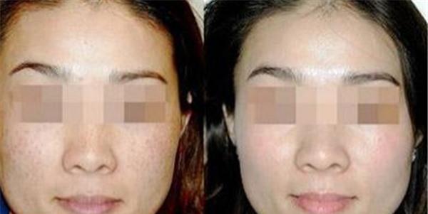 做激光<a href=http://m.f3bb6.cn/listinfo-795-0.html target=_blank class=infotextkey>祛斑</a>價格多少錢