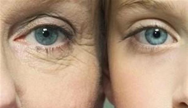 做果酸換膚<a href=http://m.f3bb6.cn/listinfo-782-0.html target=_blank class=infotextkey>去眼角細紋</a>費用多少錢