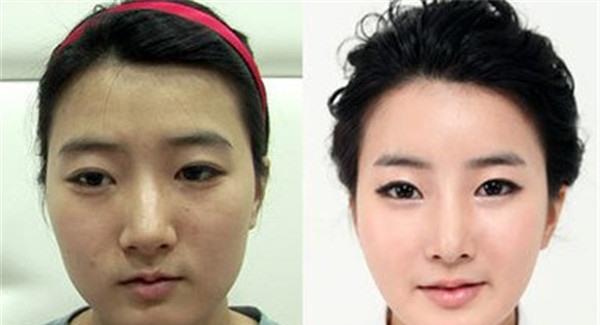 做E光<a href=http://m.f3bb6.cn/listinfo-770-0.html target=_blank class=infotextkey>嫩膚</a>價格