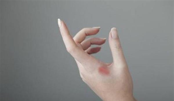 <a href=http://m.f3bb6.cn/listinfo-783-0.html target=_blank class=infotextkey>祛疤</a>副作用有哪些