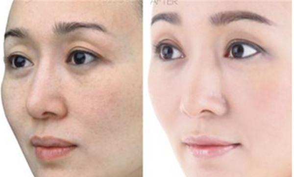 果酸<a href=http://m.f3bb6.cn/listinfo-770-0.html target=_blank class=infotextkey>嫩膚</a>適用于哪些人?