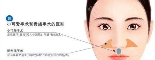 自體脂肪<a href=http://m.f3bb6.cn/listinfo-792-0.html target=_blank class=infotextkey>去法令紋</a>手術安全嗎？