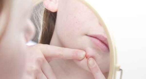 做脈沖光去痘印手術注意事項是什么？