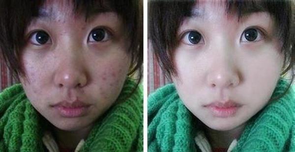 做像素激光多少錢