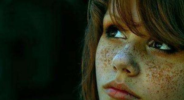 做冷光祛雀斑禁忌人群及適宜人群有哪些？