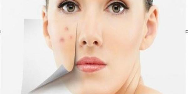 <a href=http://m.f3bb6.cn/listinfo-767-0.html target=_blank class=infotextkey>祛痣</a>會腫嗎