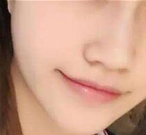 醫(yī)院<a href=http://m.f3bb6.cn/listinfo-772-0.html target=_blank class=infotextkey>去紅血絲</a>的價(jià)格