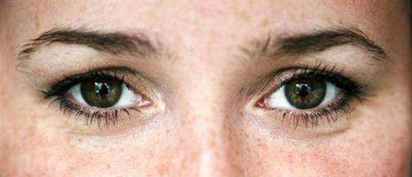 e光<a href=http://m.f3bb6.cn/listinfo-795-0.html target=_blank class=infotextkey>祛斑</a>是如何祛除老年斑的