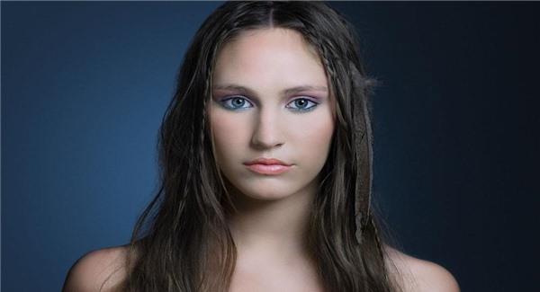 激光祛紅血絲有用嗎