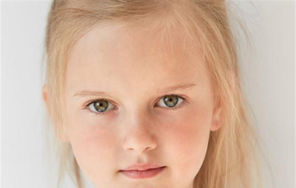 4歲得了太田痣可以激光嗎