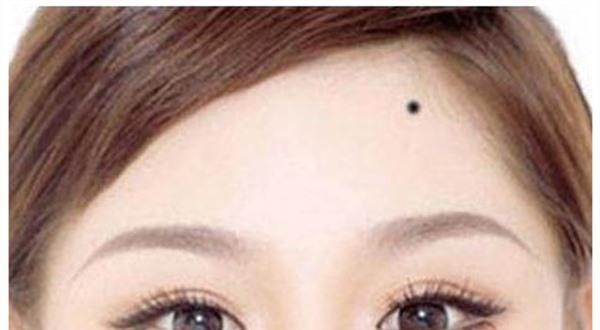 激光去痣有什么危害