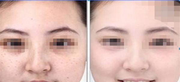 最有效果的<a href=http://m.f3bb6.cn/listinfo-795-0.html target=_blank class=infotextkey>祛斑</a>方法有哪些