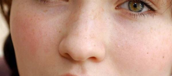 吃什么可以<a href=http://m.f3bb6.cn/listinfo-795-0.html target=_blank class=infotextkey>祛斑</a>