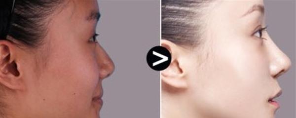 做像素激光的效果好嗎