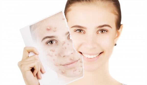 激光<a href=http://m.f3bb6.cn/listinfo-797-0.html target=_blank class=infotextkey>去痘疤</a>價格