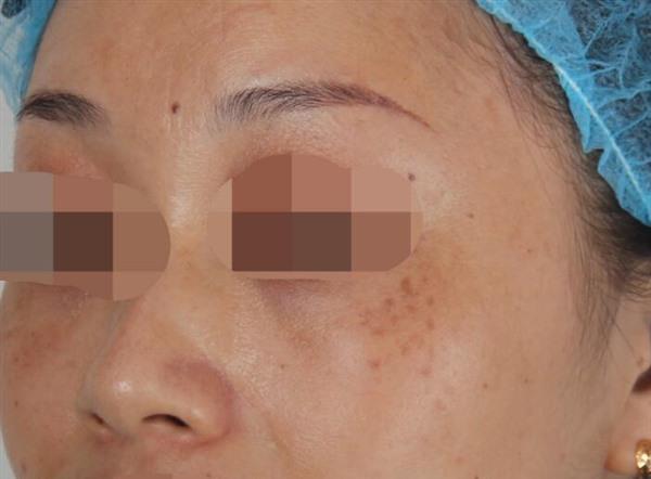 <a href=http://m.f3bb6.cn/listinfo-767-0.html target=_blank class=infotextkey>祛痣</a>的方法有哪些