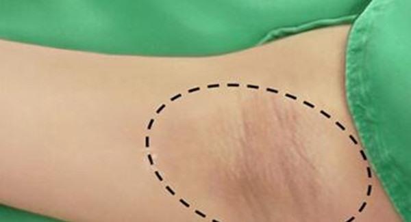 做<a href=http://m.f3bb6.cn/listinfo-784-0.html target=_blank class=infotextkey>去狐臭</a>手術(shù)時間是多久？