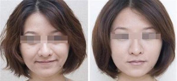 做<a href=http://m.f3bb6.cn/listinfo-734-0.html target=_blank class=infotextkey>愛貝芙</a><a href=http://m.f3bb6.cn/listinfo-792-0.html target=_blank class=infotextkey>去法令紋</a>費(fèi)用大概需要多少