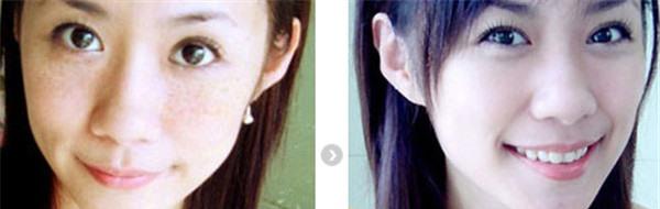 做<a href=http://m.f3bb6.cn/listinfo-795-0.html target=_blank class=infotextkey>祛斑</a>價格