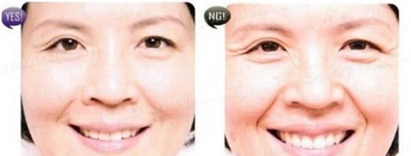 <a href=http://m.f3bb6.cn/listinfo-780-0.html target=_blank class=infotextkey>去魚尾紋</a>失敗修復需要注意什么?