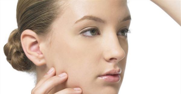 激光祛痘要花多少錢