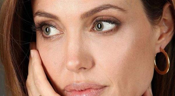 激光祛紅血絲的注意事項