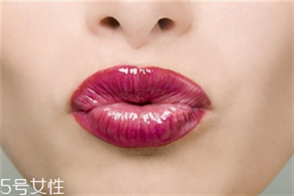 漂唇顏色太深怎么回事?這樣避免漂唇的副作用