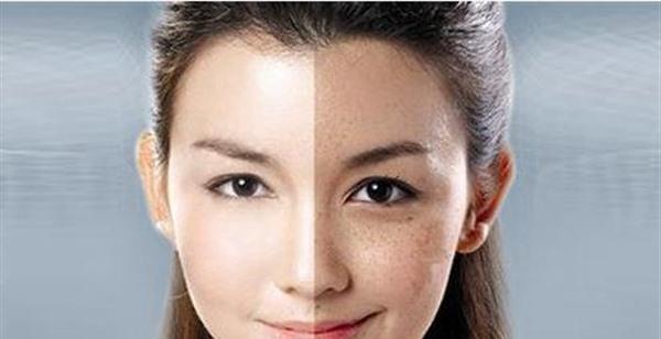 激光<a href=http://m.f3bb6.cn/listinfo-795-0.html target=_blank class=infotextkey>祛斑</a>手術的方法是什么？